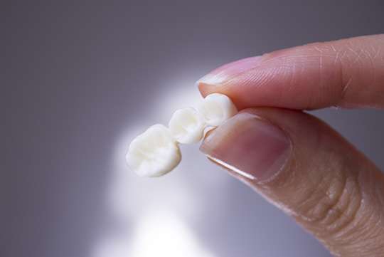 Zirconia crowns and bridges